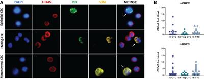 The potential of using circulating tumour cells and their gene expression to predict docetaxel response in metastatic prostate cancer